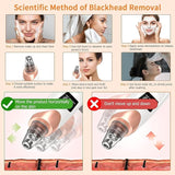 Blackhead Remover “Comes with a Warranty”